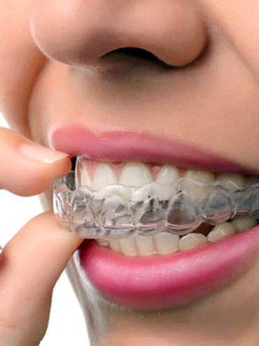 https://drpriyaaesthetics.co.uk/wp-content/uploads/2021/10/invisalign.webp